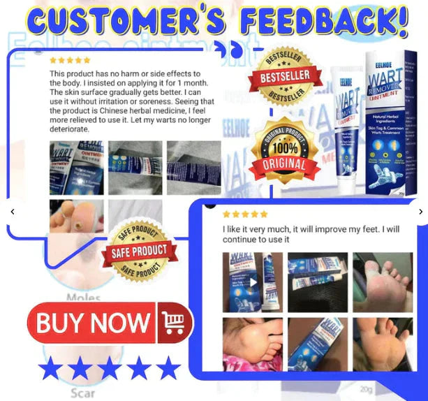 Instant Wart Removal Cream - 100g [ BUY 1 GET 1 FREE]