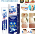 Instant Wart Removal Cream - 100g [ BUY 1 GET 1 FREE]